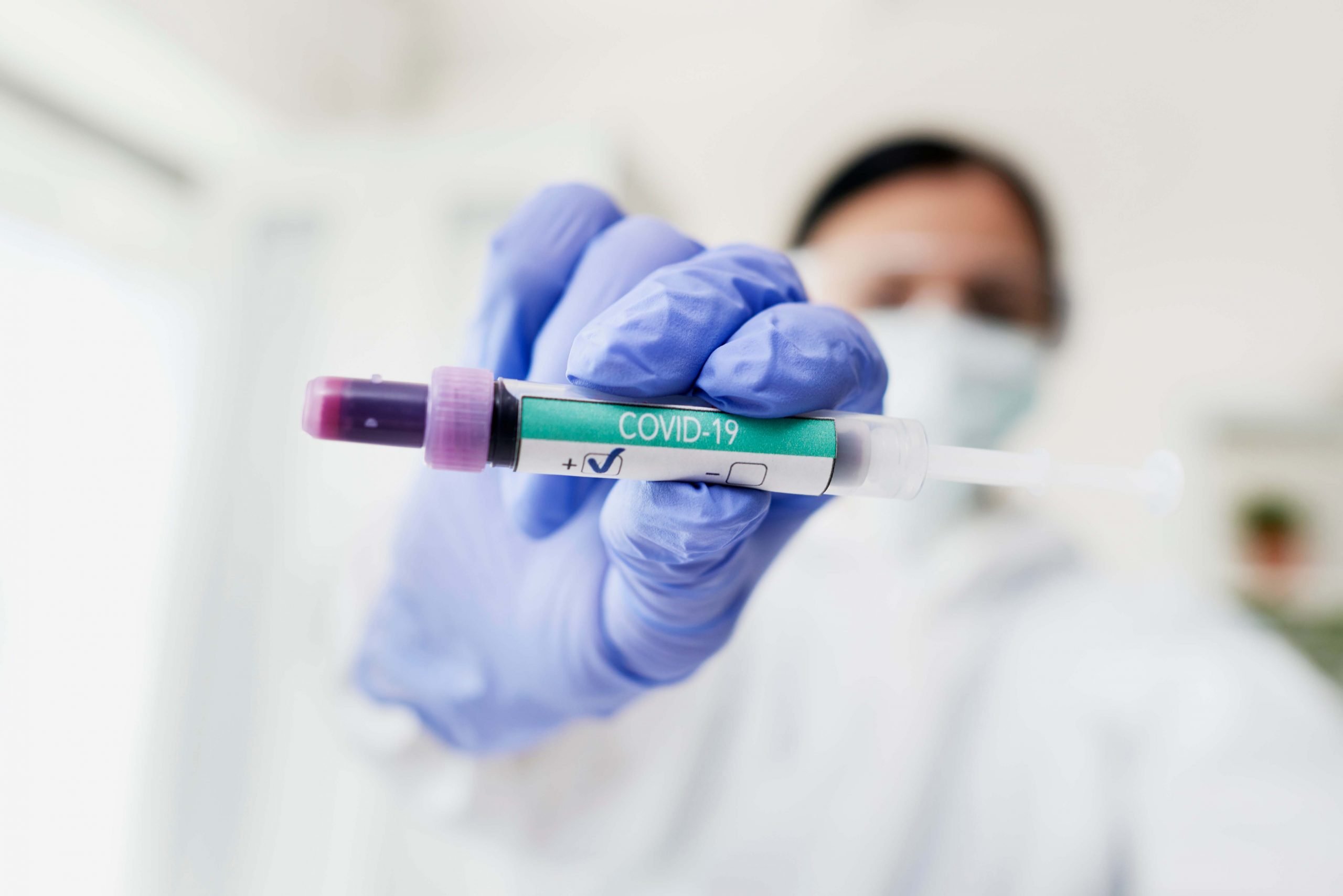 İngiltere ülkeye giriş öncesi ve sonrasında PCR testlerini kaldırıyor 1 covid vaka scaled