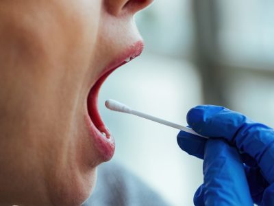 Ingilterede Yahudi kokenli kisilere kanser riski testi teklif edilecek