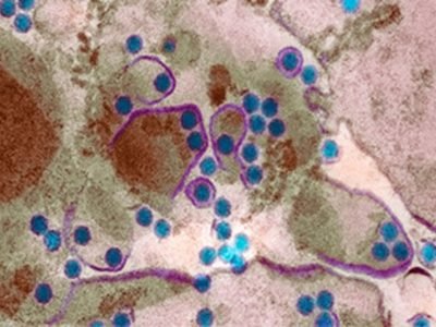 Dengue fever H