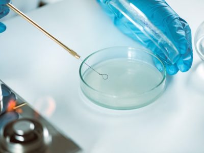 IVF Tedavisi