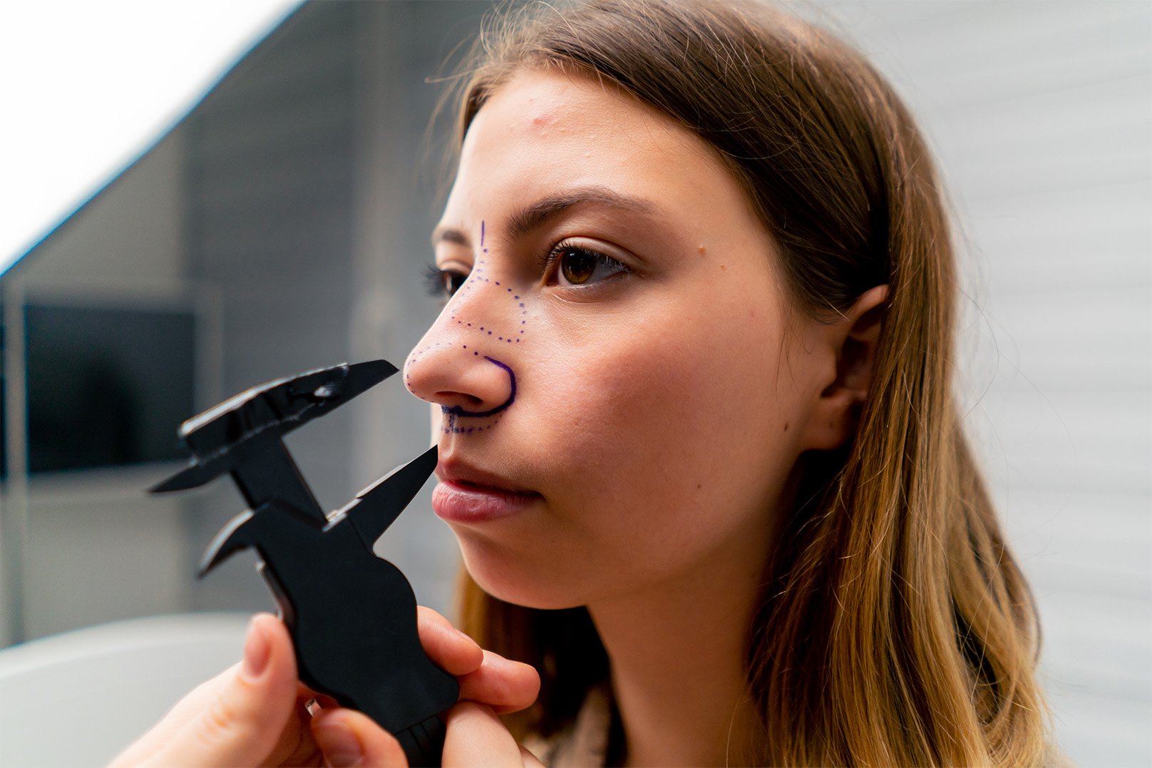 Rhinoplasty