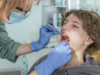 trauma to teeth